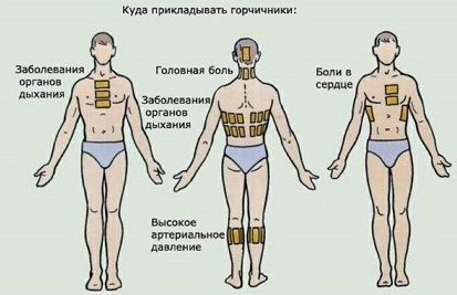 изображение куда прикладывать горчичники на тело при головной боли,боли в сердце,заболеваний органов дыханий,высоком артериальном давлении